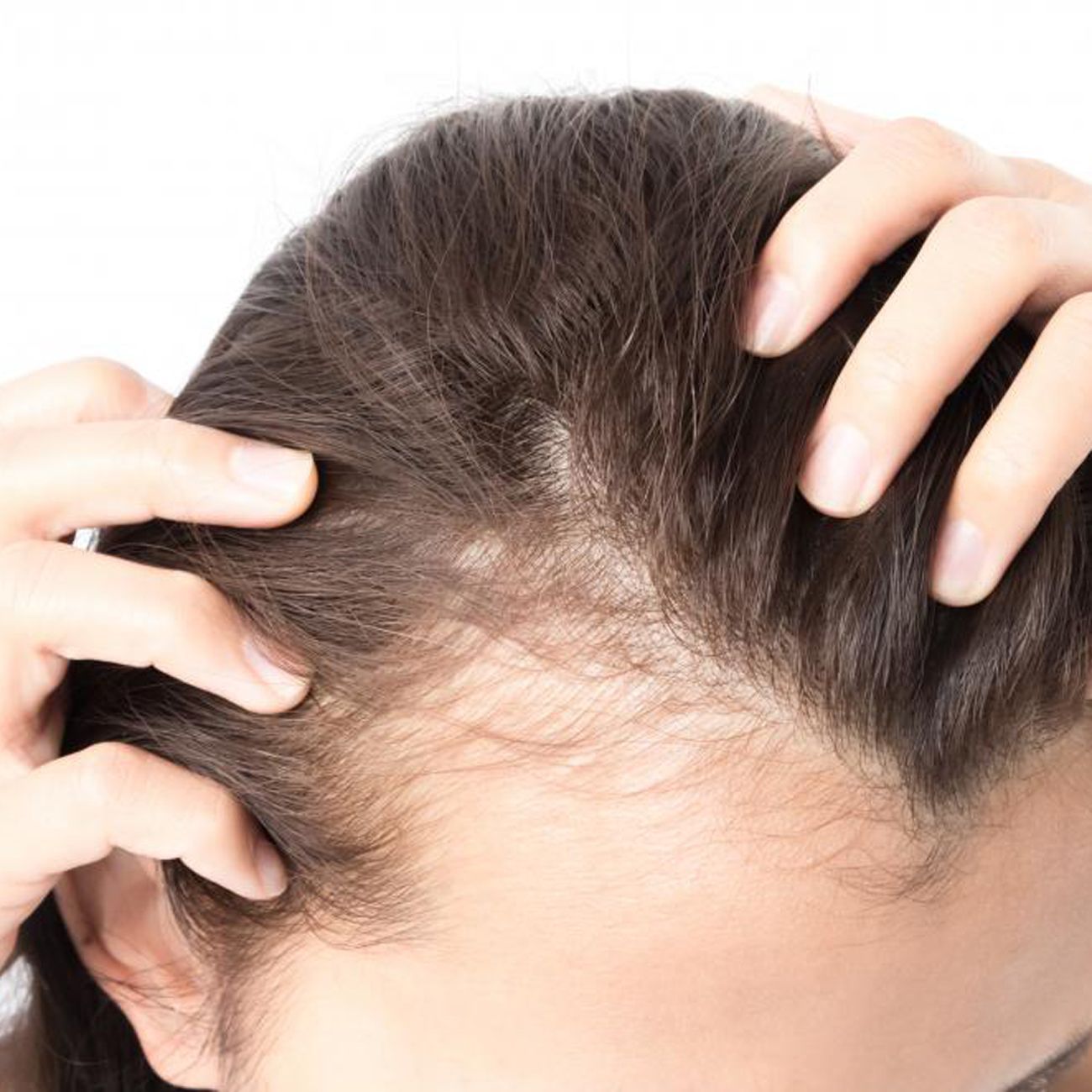 pravastatin side effects hair loss