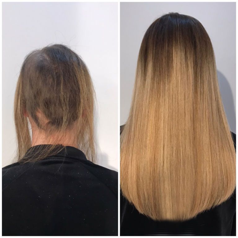 Hair Integration System Edinburgh Wigs Edinburgh